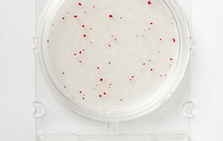 Food microbiology testing_Compact Dry AQ_red colonies of heterotrophic water bacteria