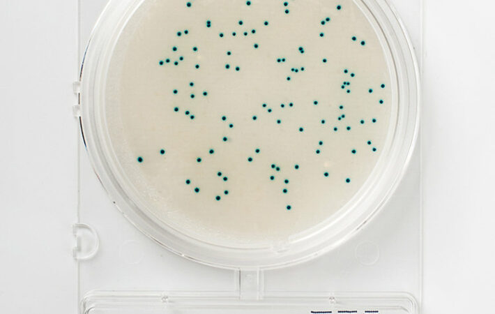 Food microbiology testing_Compact Dry ETC_blue colonies on membrane filter from trinking water sample