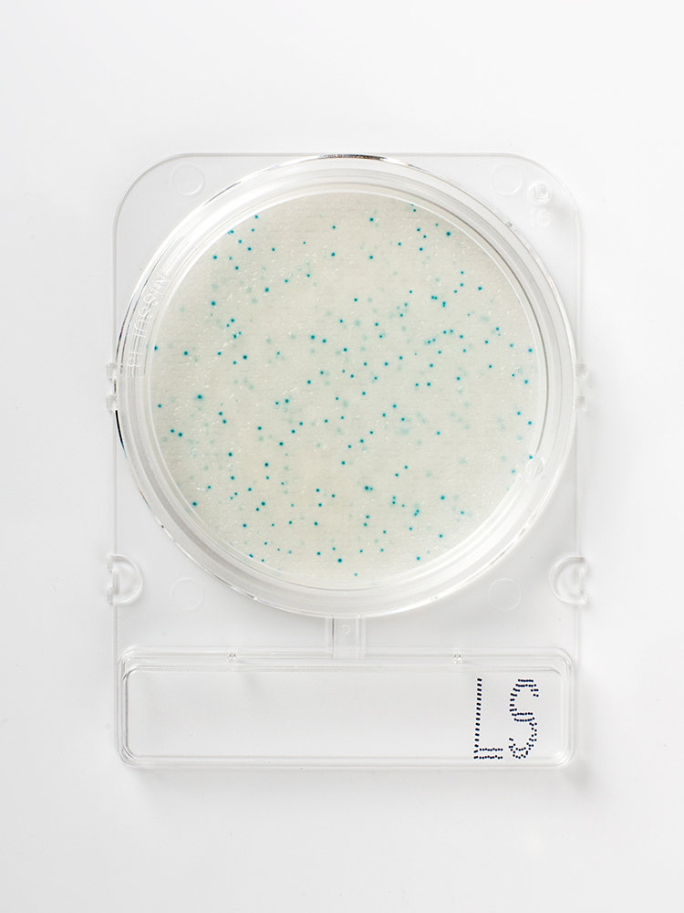 Food microbiology testing_Compact Dry LS_Listeria-monocytogenes light-blue colonies