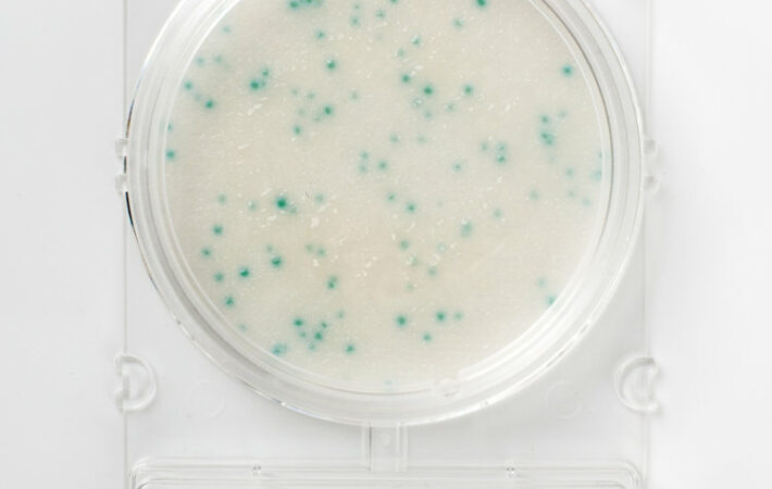 Food microbiology testing_Compact Dry X-SA_blue colonies of S-aureus from milk sample